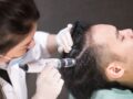 what is a scalp treatment